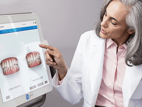 iTero Invisalign Scanner